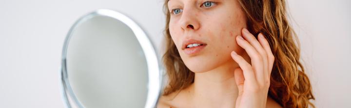 Carein: badania nie kłamią - kondycja skóry wpływa mocno na stan psychiczny